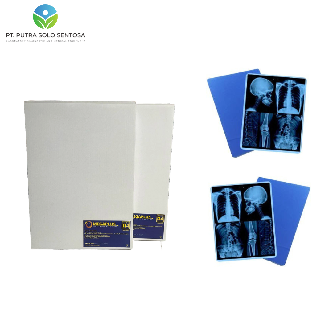 Blue Inkjet Xray Film Omegaplus